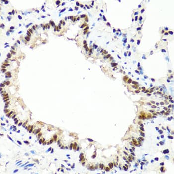 TET2 Antibody
