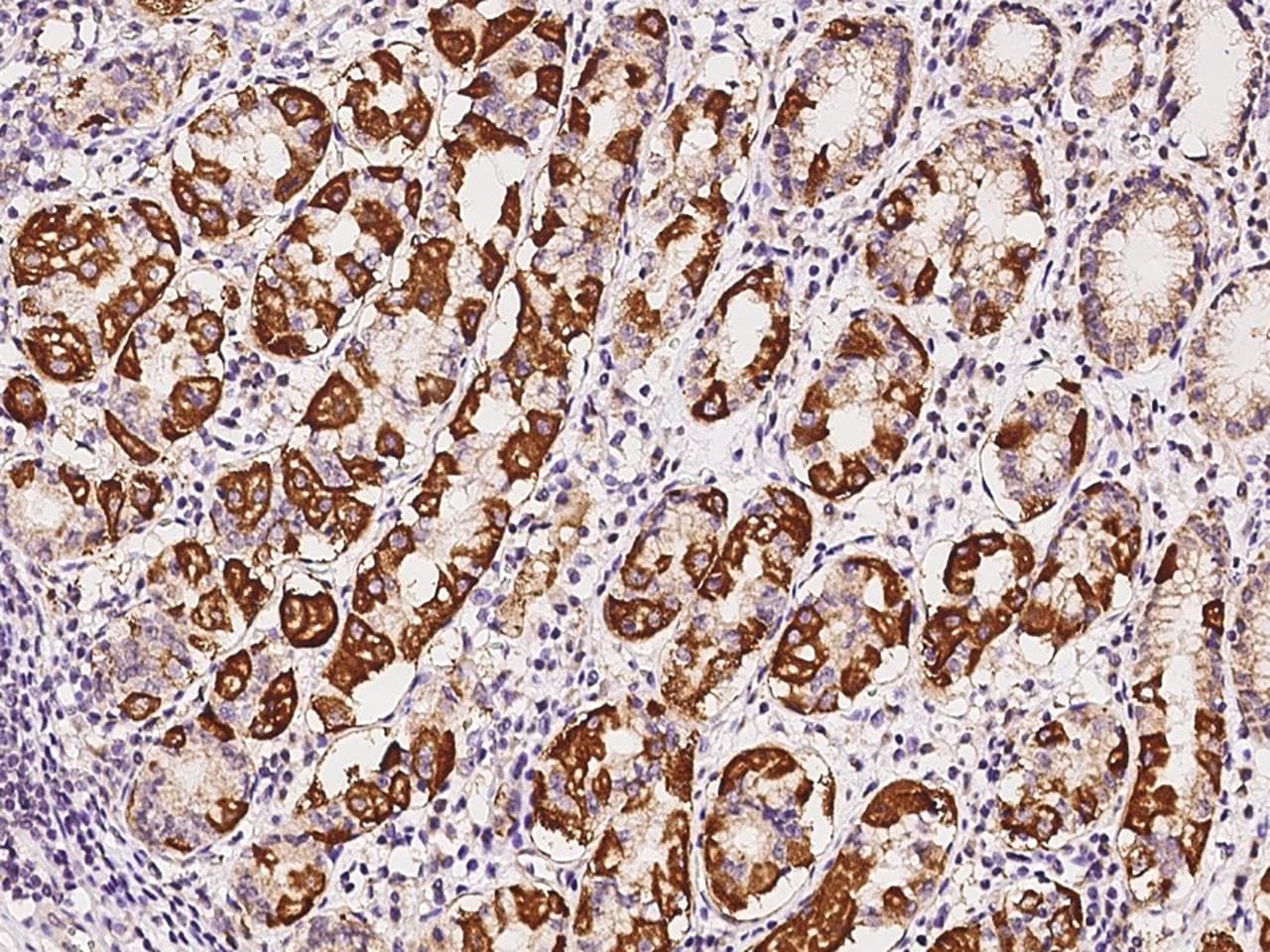 KIAA0828 / AHCYL2 Antibody
