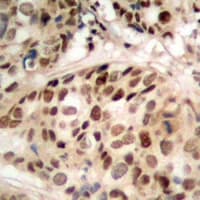 Polyclonal Rabbit anti-Human PHF1 Antibody (Internal, IHC, WB)