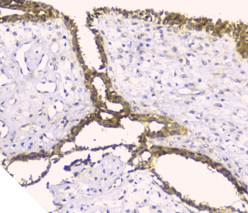 HAS1 / HAS Antibody