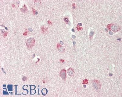 ST6GALNAC1 Antibody (aa396-445)