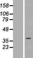 SLC25A32 Protein (Over-Expression Lysate Myc-DDK (Flag))