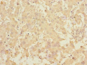 Polyclonal Rabbit anti-Human RCHY1 / PIRH2 Antibody (IHC)