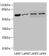 Polyclonal Rabbit anti-Human NOX3 Antibody (IHC, WB)