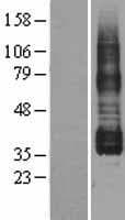 PTGIR / IP Receptor Protein (Over-Expression Lysate Myc-DDK (Flag))