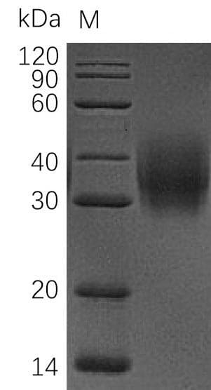 Human CD47 Protein (Recombinant 6His, C-terminus)