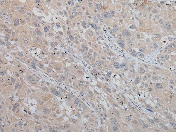 MLANA / Melan-A Antibody