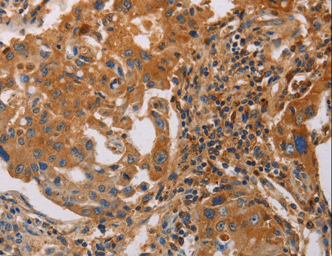 Polyclonal Rabbit anti-Human MMP1 Antibody (IHC)