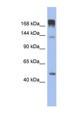 Polyclonal Rabbit anti-Human SLIT3 Antibody (aa467-516, WB)