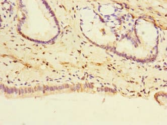 PTPMEG / PTPN4 Antibody