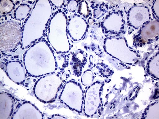 KRT16 / CK16 / Cytokeratin 16 Antibody (clone OTI2F3)