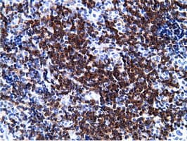 Monoclonal Mouse anti-Human BCAP / PIK3AP1 Antibody (clone OTI7A11, IHC, IF, WB)