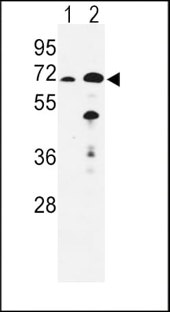 IHC-plus™ EHHADH / Enoyl-Coa Hydratase Antibody (aa662-690)
