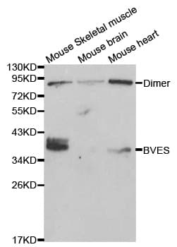 IHC-plus™ Polyclonal Rabbit anti-Human BVES Antibody (aa241-360, IHC, WB)
