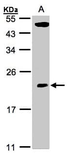 TPRKB Antibody (aa1-175)