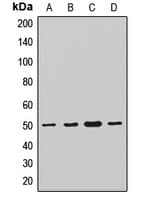 TMLHE / TMID Antibody