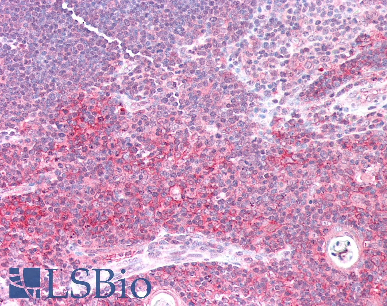 IHC-plus™ HLA-F Antibody