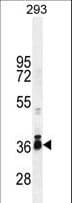 STRA8 Antibody (aa286-315)