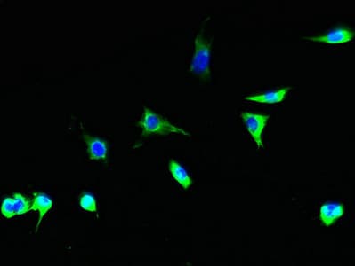 Polyclonal Rabbit anti-Human TSTA3 / GDP-L-Fucose Synthase Antibody (IHC, WB)