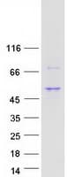 Human TMEM246 Protein (Recombinant Myc-DDK (Flag))