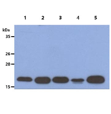 ACP1 / Acid Phosphatase Antibody (clone AT5C11)