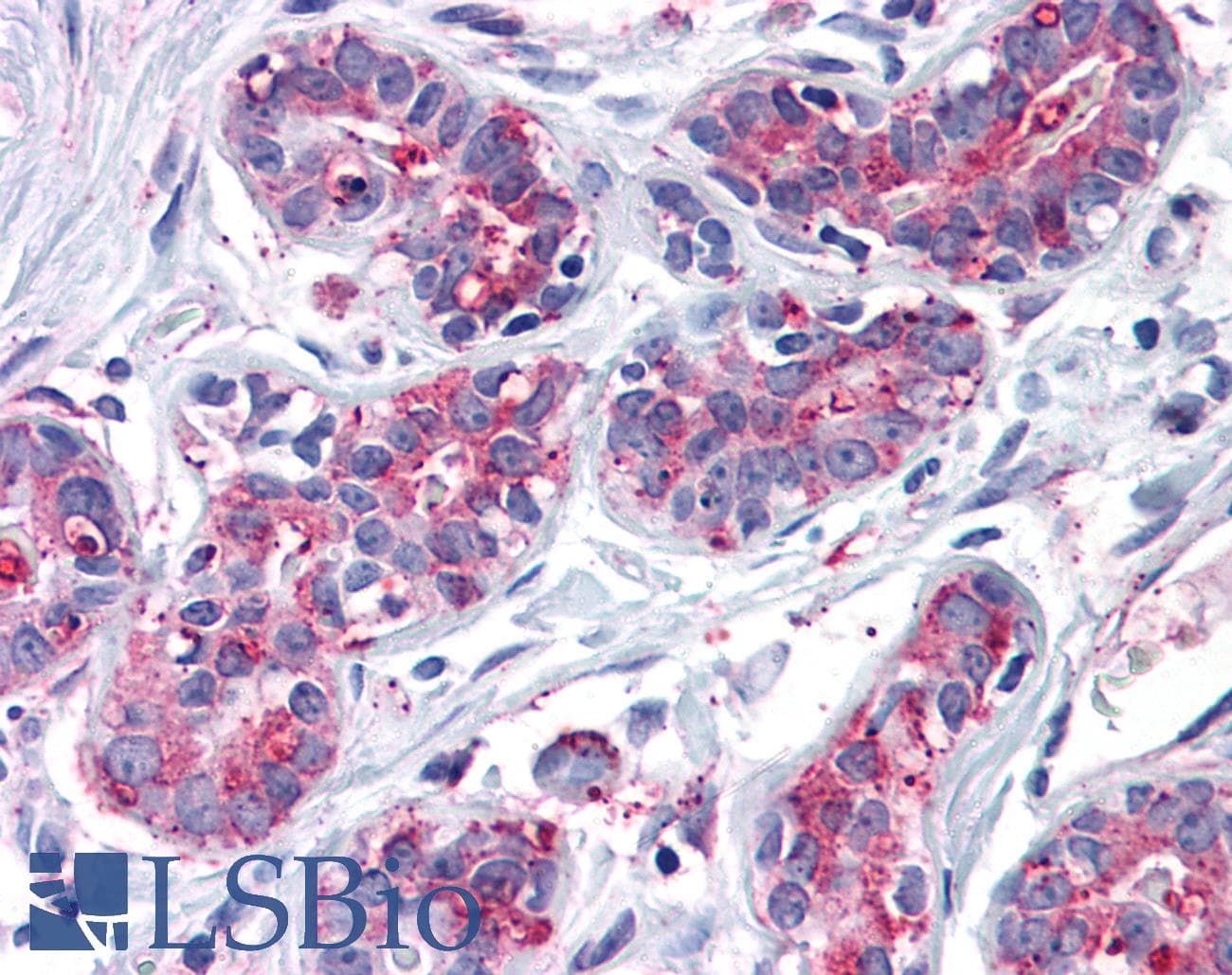 IHC-plus™ Polyclonal Rabbit anti-Human ENTPD2 Antibody (Internal, IHC)