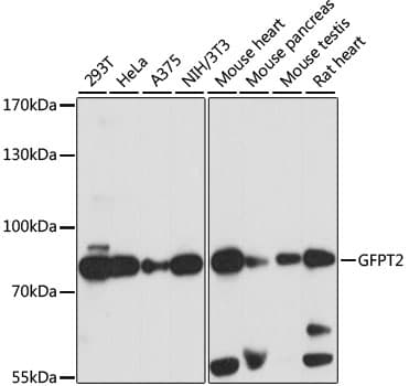 Polyclonal Rabbit anti-Human GFPT2 Antibody (WB)