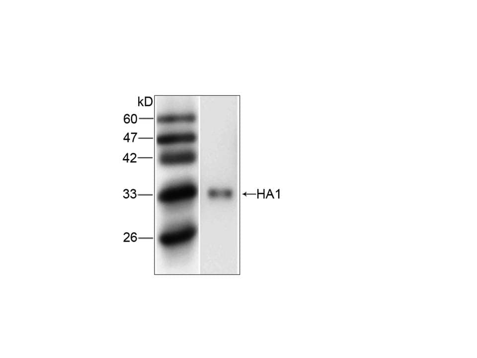 Influenza A Virus H1 Antibody (aa102-341)