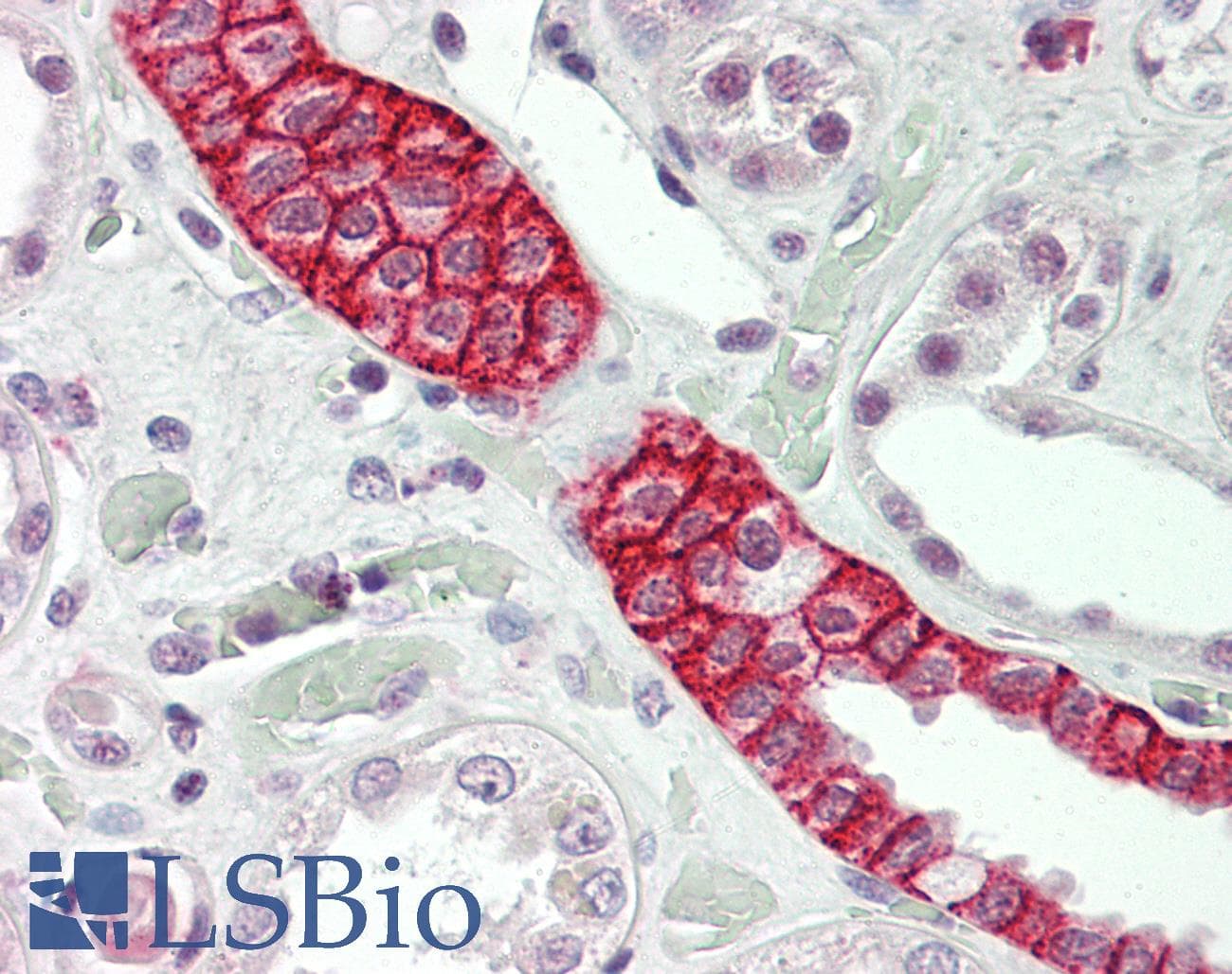 IHC-plus™ AQP3 / Aquaporin 3 Antibody (aa74-292)
