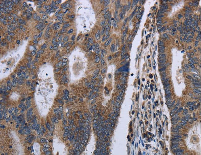 GSTA3 Antibody