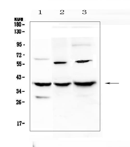 IGFBP2 / IGF-BP53 Antibody