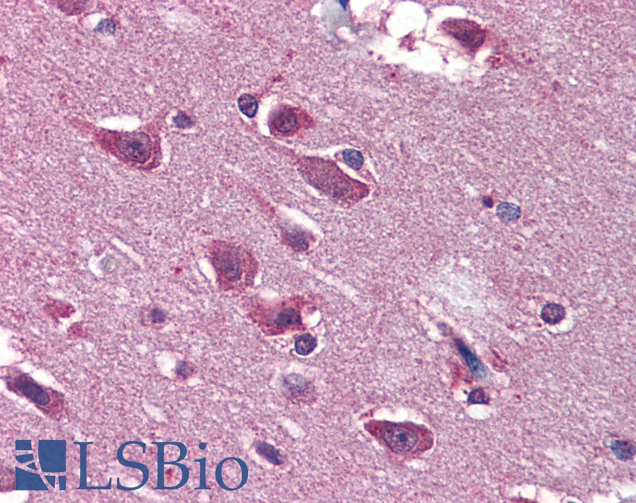 PathPlus™ BRAF / B-Raf Antibody (clone 1H12)