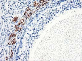 ELK3 / NET Antibody (clone OTI2F12)