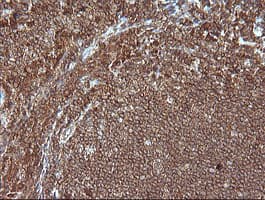 MAP2K1 / MKK1 / MEK1 Antibody (clone OTI2B2, Carrier-free)