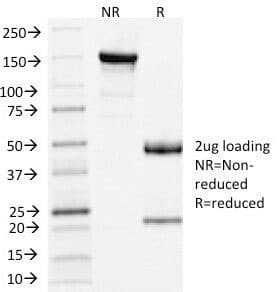 CLTA / LCA Antibody (clone CLC/1421)
