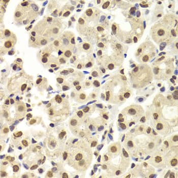 Polyclonal Rabbit anti-Human HNRNPD / AUF1 Antibody (IHC, WB)