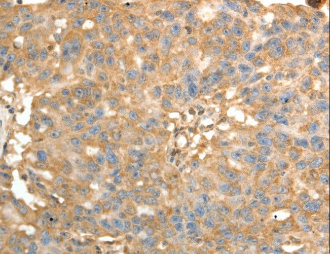 PSMD9 / 26S Proteasome Antibody