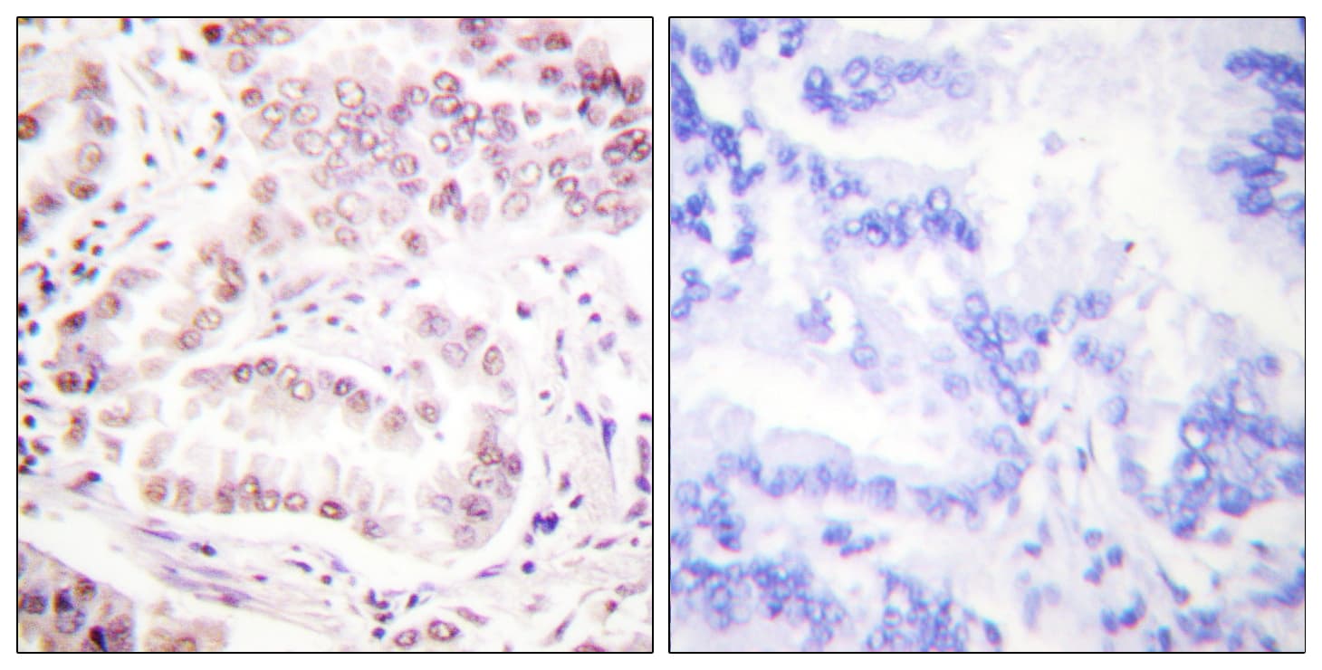 Histone H3 Antibody (Acetyl-Lys27)
