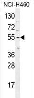 TRIM65 Antibody (aa327-355)