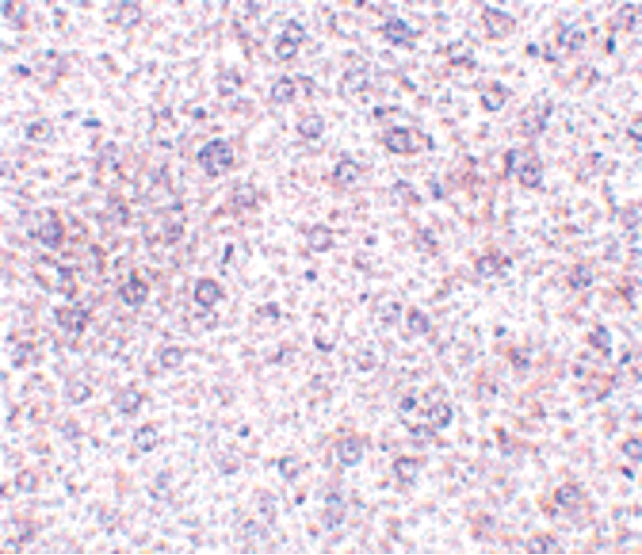 TEM7 Antibody