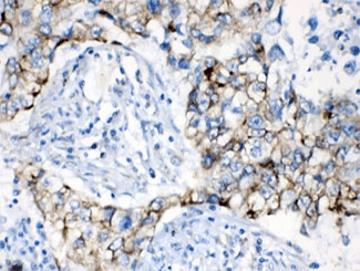 AK2 / Adenylate Kinase 2 Antibody