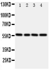 TXNRD2 Antibody (aa418-434)