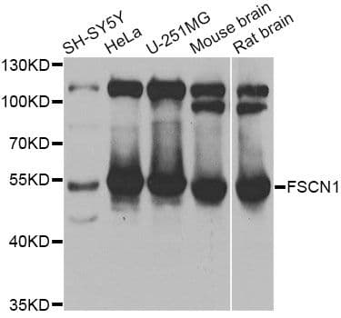 FSCN1 / Fascin Antibody