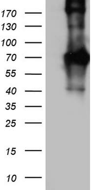 Monoclonal Mouse anti-Human CD68 Antibody (clone OTI10E4, aa22-319, WB)
