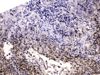 HDGF Antibody