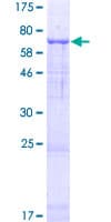 Human TMEM39A Protein (Recombinant GST)