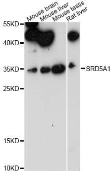 5-Alpha Reductase / SRD5A1 Antibody