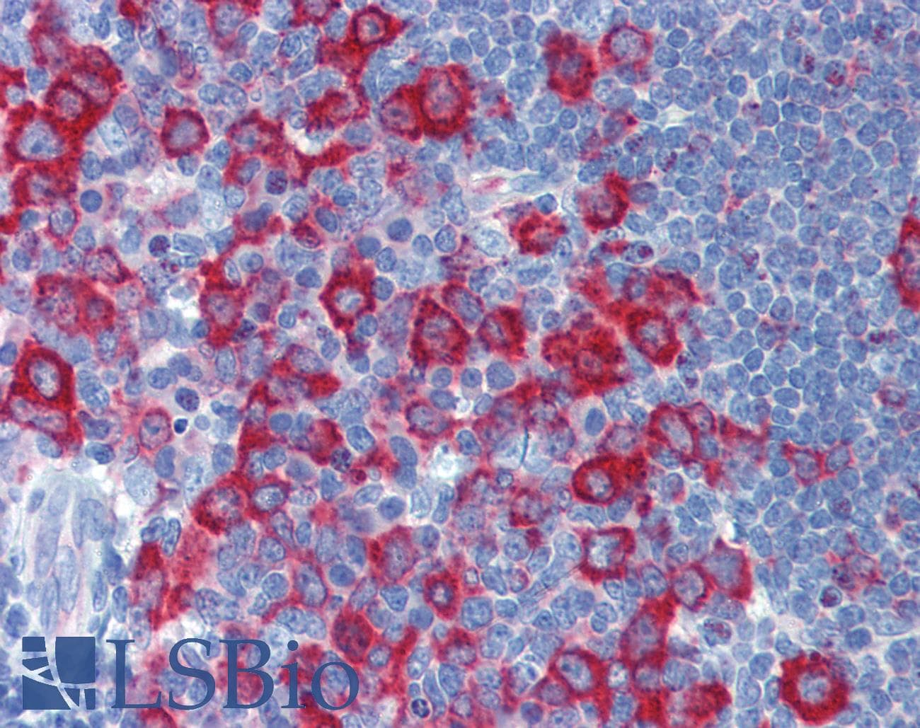 Polyclonal Rabbit anti-Human PRKRA / PACT Antibody (N-Terminus, IHC, WB)