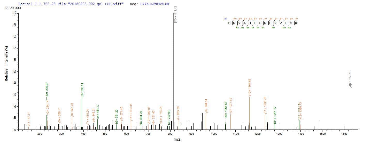 Plasmodium falciparum MSP1 Protein (Recombinant 10His, N-terminus)
