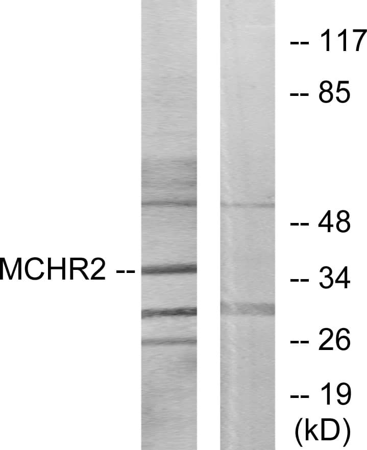 Polyclonal Rabbit anti-Human MCHR2 Antibody (aa291-340, WB)